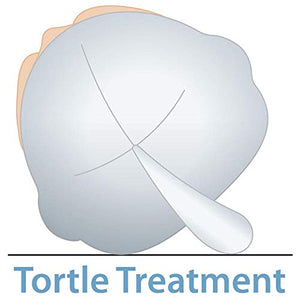 TORTLE Repositioning Beanie,  Adjustable Head Support Prevents Flat Head, FDA Cleared, Neck Positioner (Lucky Elephant)